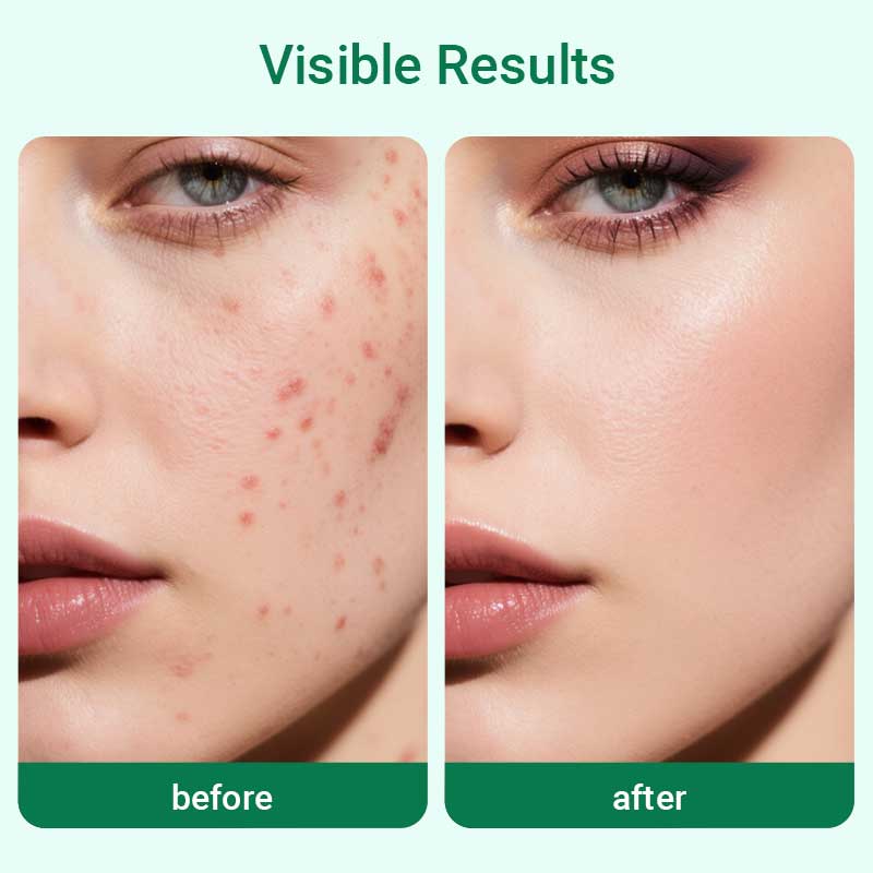 private label blemish solution facial cleanser